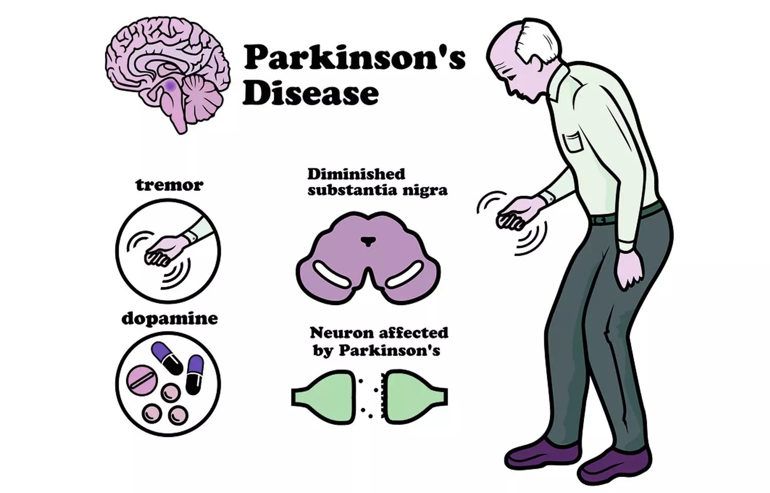 Parkinson Treatment Neurotherapy Punjab, Neurotherapist Punjab,