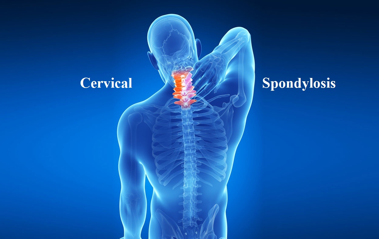 Cervical Spondylosis Treatment